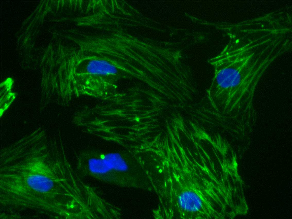 upward-81-xu-blue-green-heart-muscle Heart muscle cells stained for muscle proteins (green) and nuclei (blue).